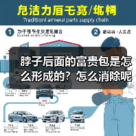 脖子后面的富贵包是怎么形成的?怎么消除呢?成都新华医院医疗美容中心为您解答 脖子后面的富贵包是怎么形成的?怎么消除呢?成都新华医院医疗美容中心为您解答